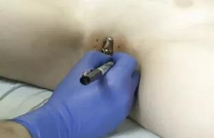 વેધન 1