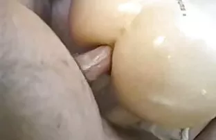 ગુદા સ્ક્વોર્ટ