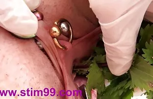 વીંછી વીંછી અને વલ્વામાં મૂત્રમાર્ગ anastomosis
